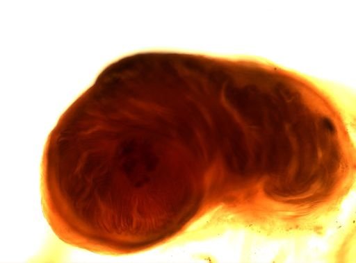 Taenia solium