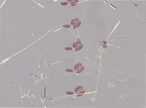 Rhopalosiphum nymphaeae