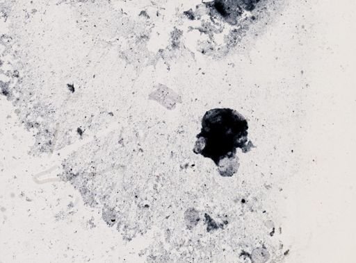Retortamonas intestinalis