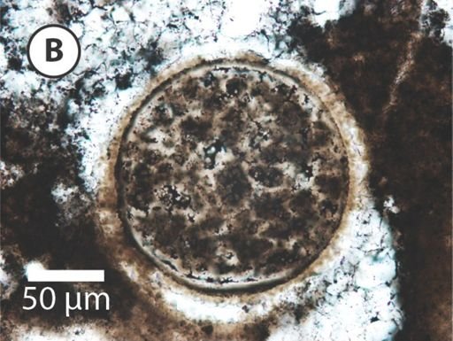 Megasphaera miniscula