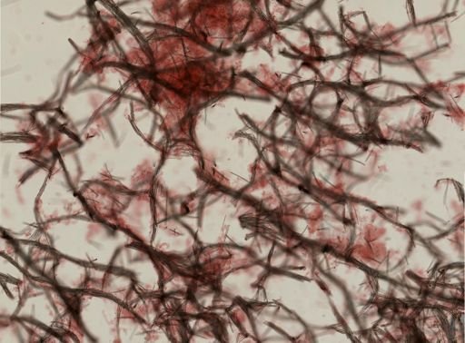 Isodictya deichmannae