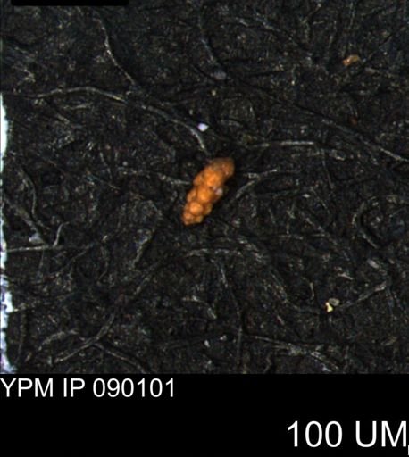 Verneuilina canadensis