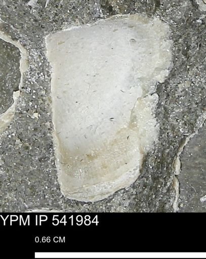 Protocardia?