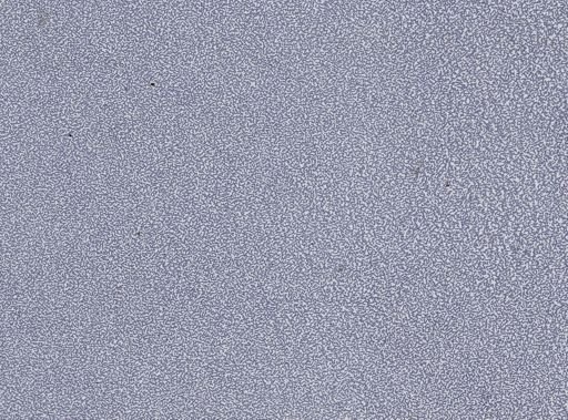 Plasmodium vivax