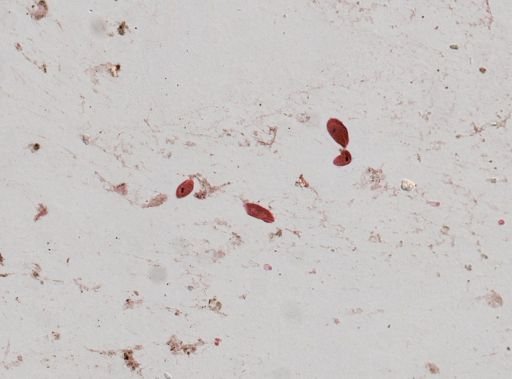 Balantidium