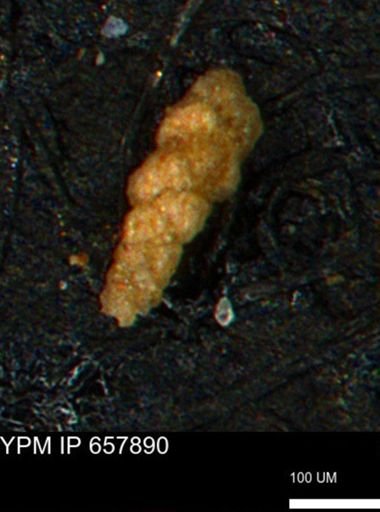 Verneuilina canadensis