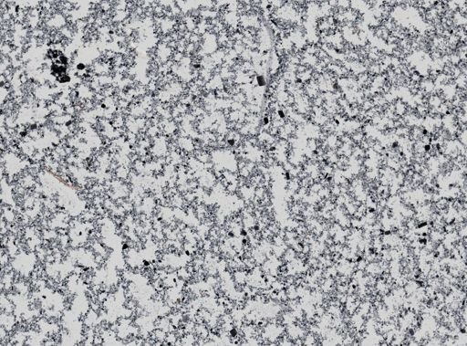 Giardia lamblia