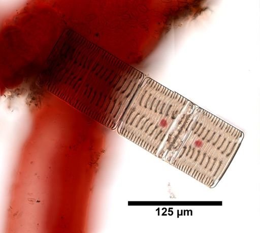 Striatella unipunctata