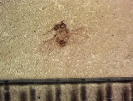 undet. Strepsiptera