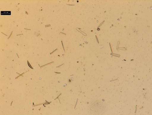 Diatoms