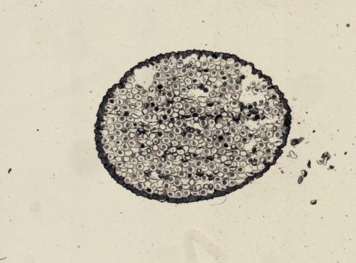 Ascaris megalocephala
