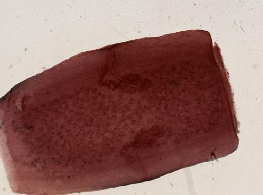 Dipylidium caninum
