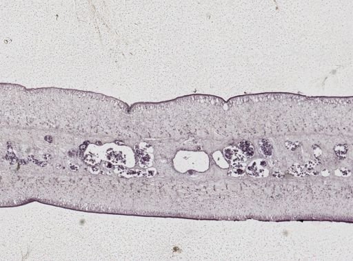 Taenia saginata