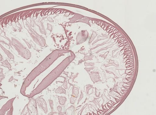 Ascaris lumbricoides