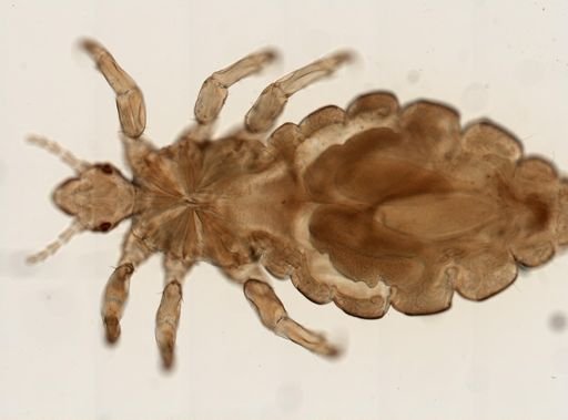 Pediculus humanus