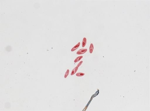 Paramecium calkinsi