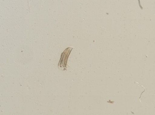 Somatogyrus depressus