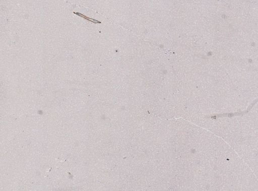 Trypanosoma equiperdum