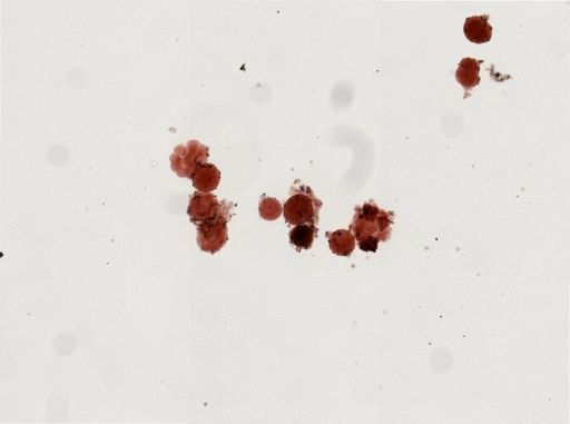 Cristatella mucedo