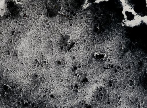 Entamoeba histolytica