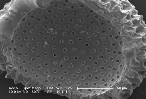 Globigerinoides ruber