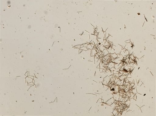 Bacillariophyceae