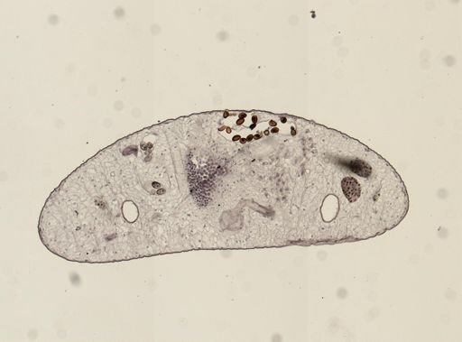 Dicrocoelium dendriticum