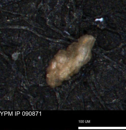 Verneuilina canadensis