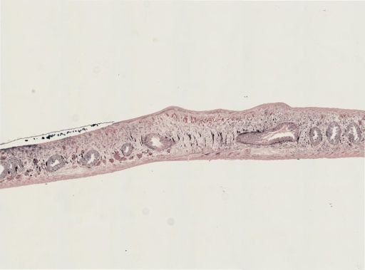 Turbellaria