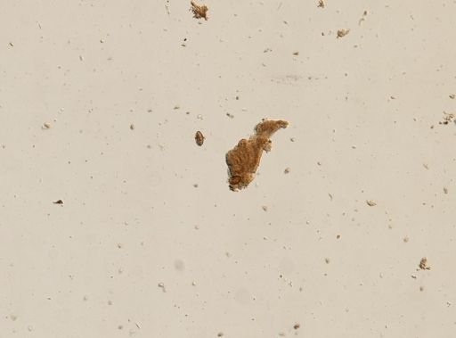 Diphyllobothrium canis