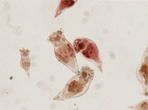 Epiphanes senta