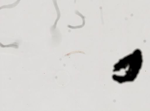 Derocheilocaris typica