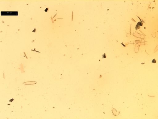 Diatoms