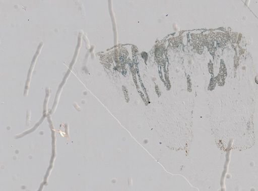 Stromatospongia norae