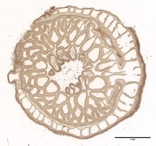 Diadumene leucolena