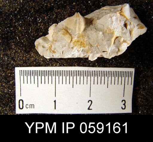 Metaplasia pyxidata