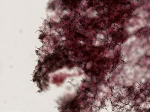 Haliclona sp.