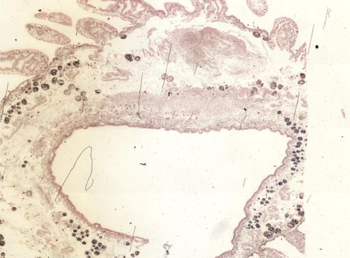 Thysanozoon brocchii