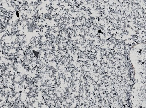 Giardia lamblia