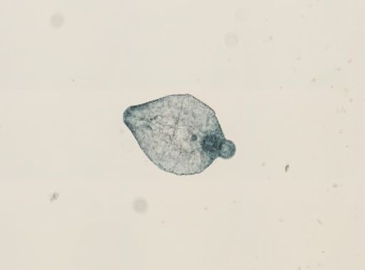 Tetracotyle