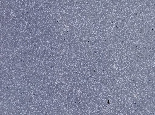 Plasmodium vivax