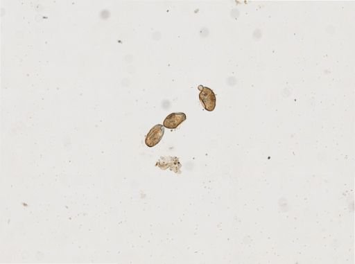 Fasciolopsis buski