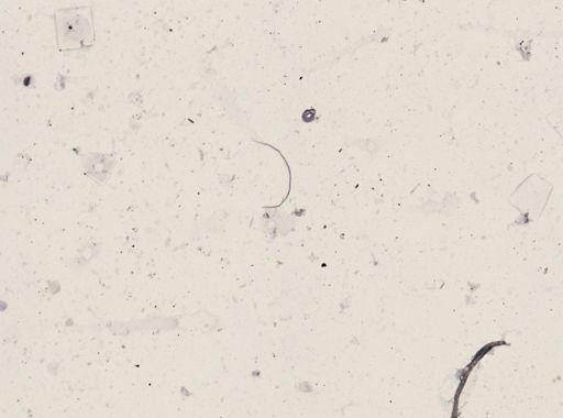 Onchocerca volvulus