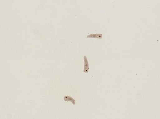 Fasciola hepatica