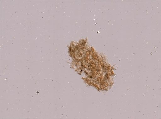 Microporella