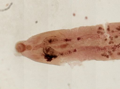 Haematoloechus medioplexus