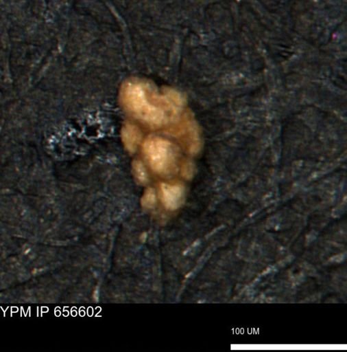 Verneuilina canadensis