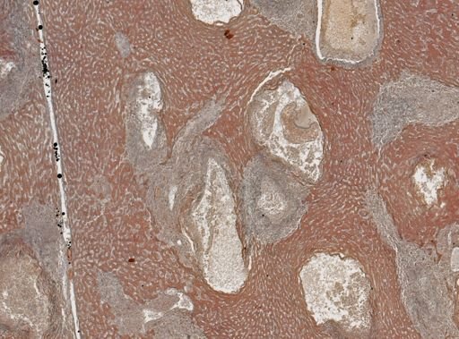 Taenia crassicollis