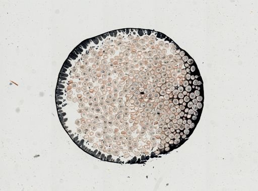 Ascaris
