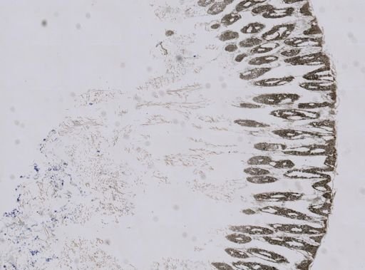 Ceratoporella nicholsoni